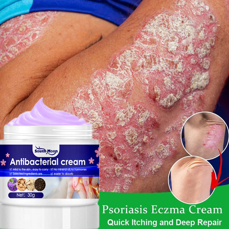 Psoriasis Antibacterial Cream for Medical Health Skin Care Products