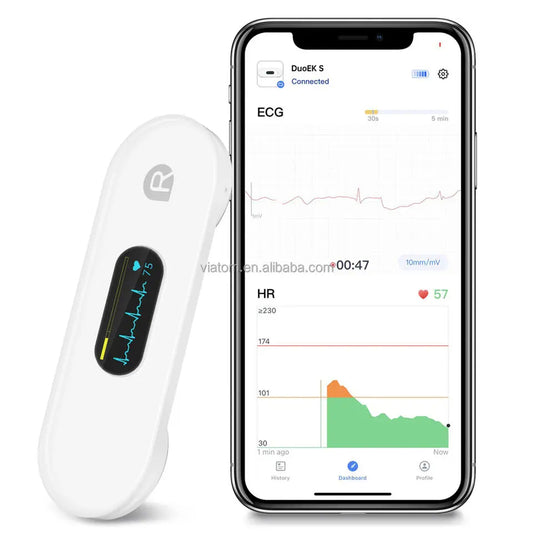 Pocket ECG Monitoring Device in Personal Health Care