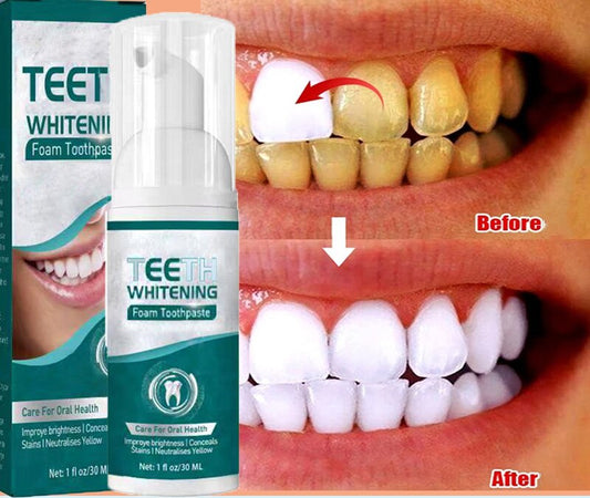 Teeth Whitening Mousse for Dental Health Care