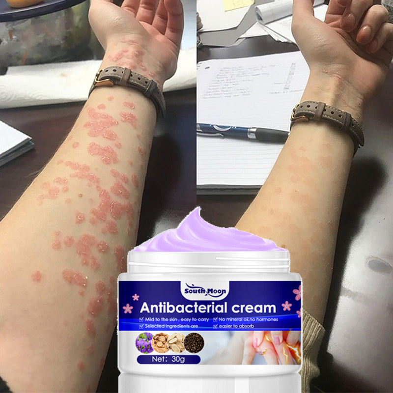 Psoriasis Antibacterial Cream for Medical Health Skin Care Products