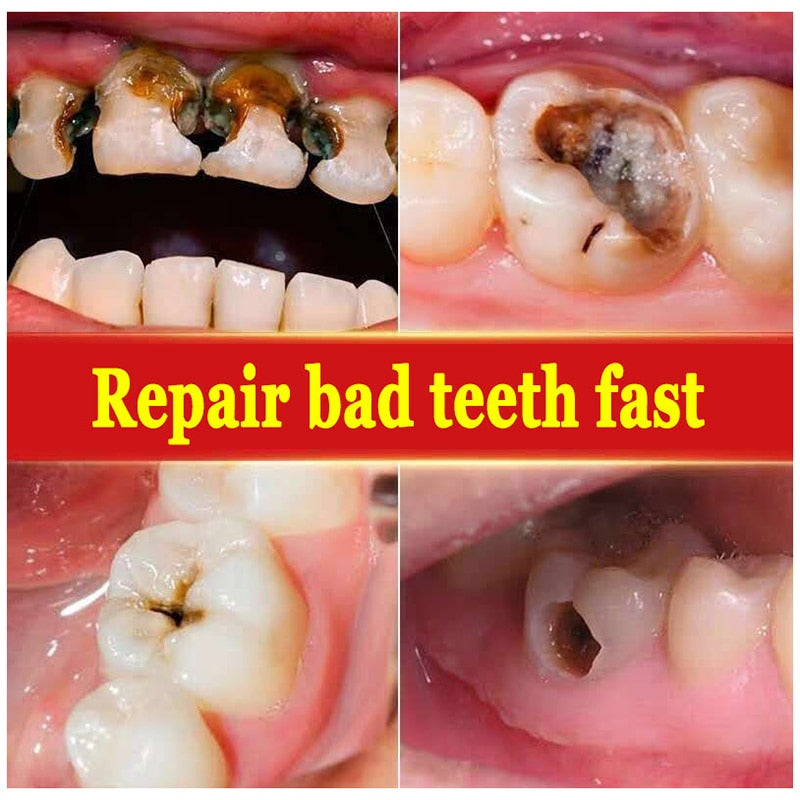 Tooth Decay Repair Paste Teeth Cleaner Plaque Remover Fresh Breath Dental Care