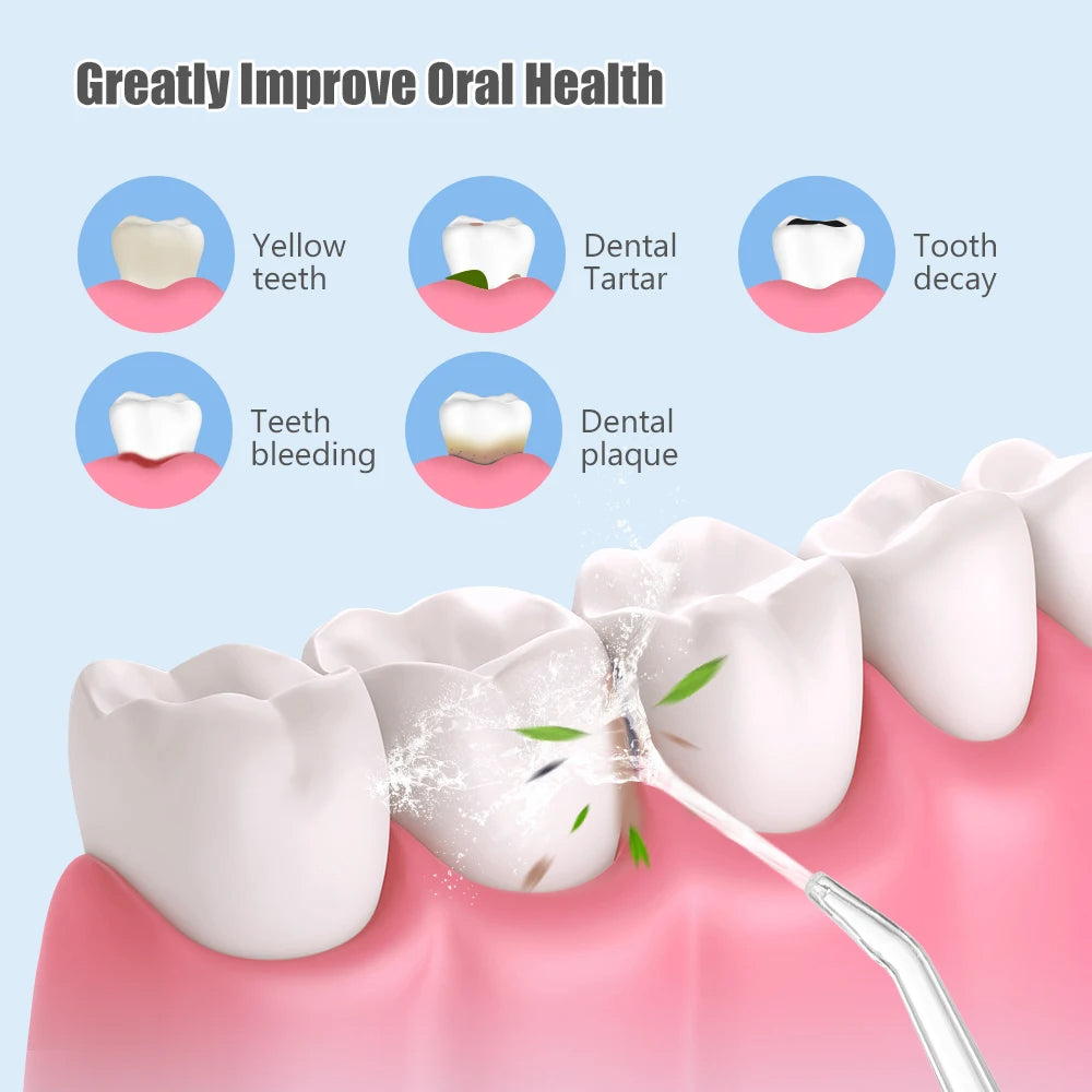 Portable Oral Irrigator for Teeth Whitening