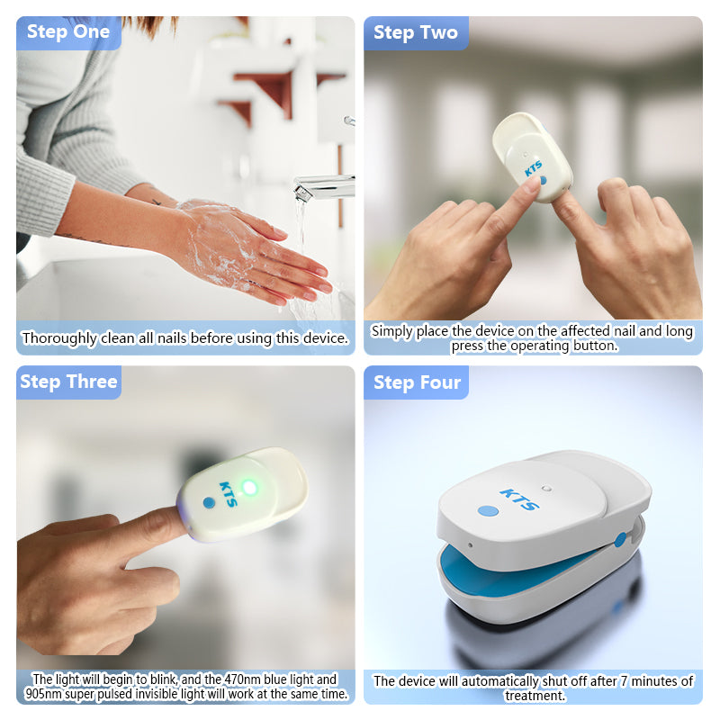 Fungal Nail Treatment Laser Device For Nail Fungus Removal