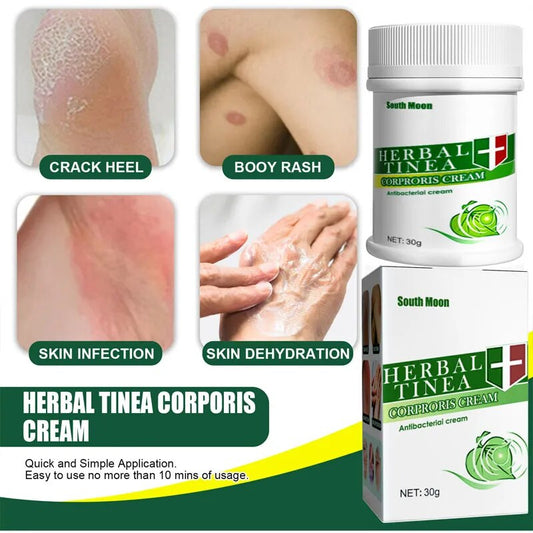 Herbal Psoriasis Cream Treatment Dermatitis Eczema