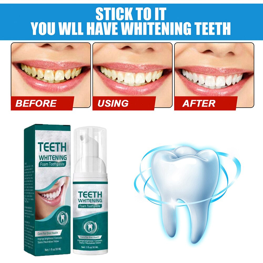 Teeth Whitening Mousse for Dental Health Care