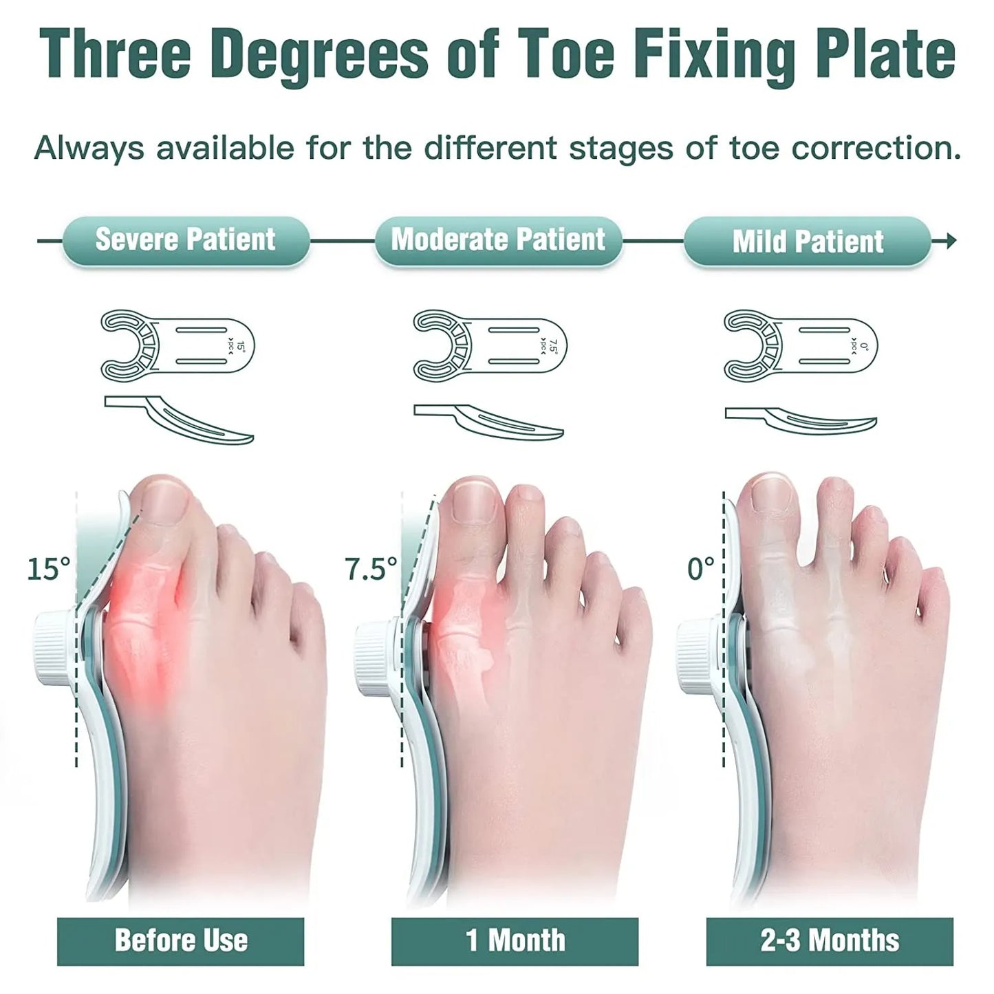 Foot Care Three-angle Fixation Correction Straightener