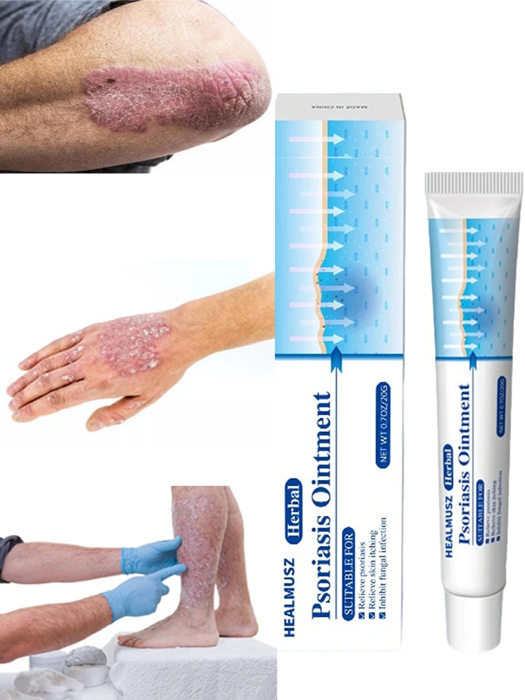 Antibacterial Itch Eczema Relief dermatitis Herbal Skin Psoriasis Cream