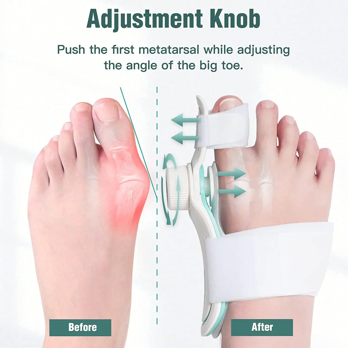 Foot Care Three-angle Fixation Correction Straightener