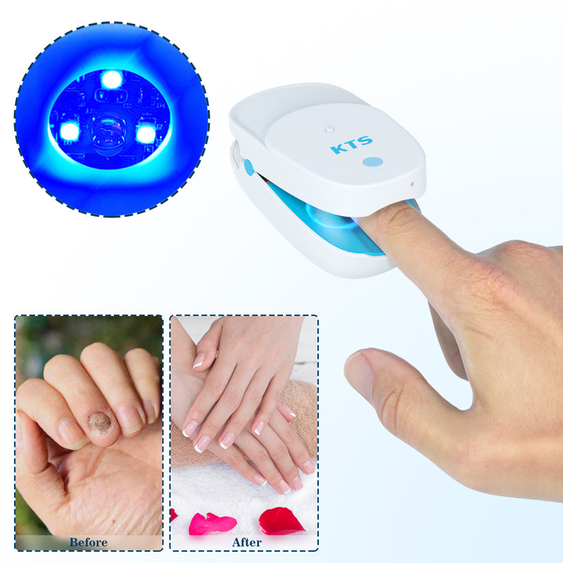 Fungal Nail Treatment Laser Device For Nail Fungus Removal