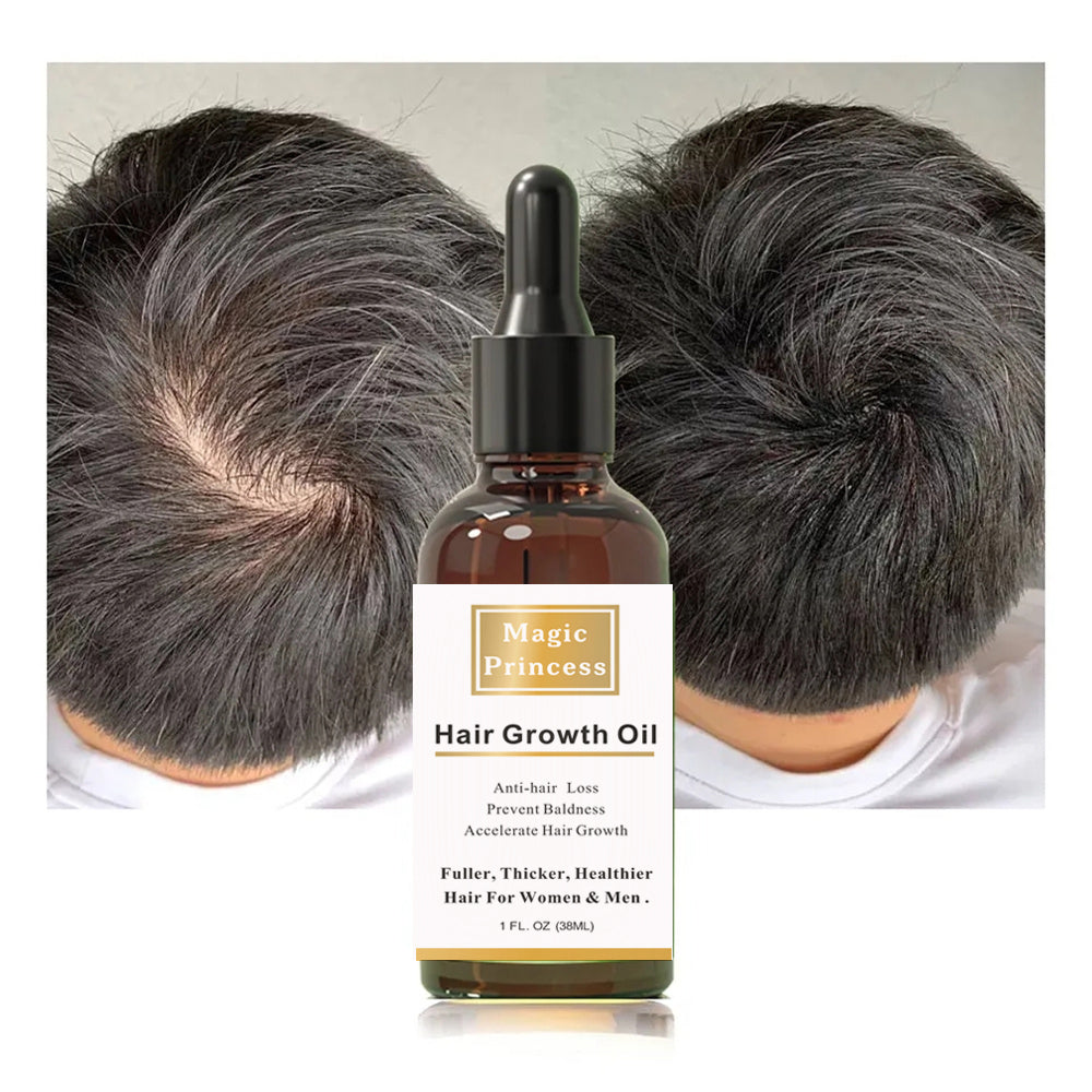 Natural Organic Mint Regrowth Hair Scalp Treatment Oil