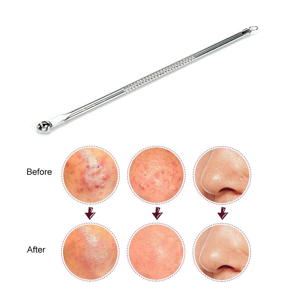 Acne Blackhead Removal Stainless Needles Black Dots Acne Remover