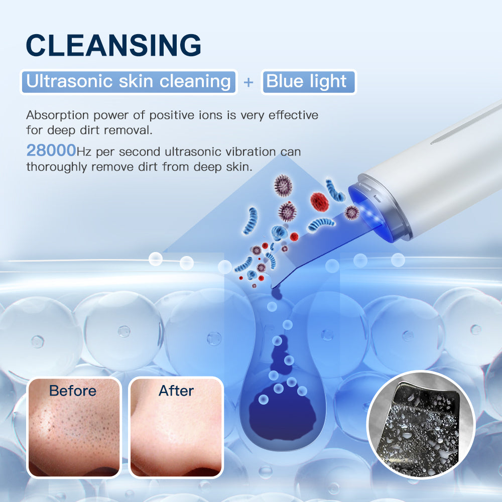 ANLAN Ultrasonic Skin Scrubber IXP5